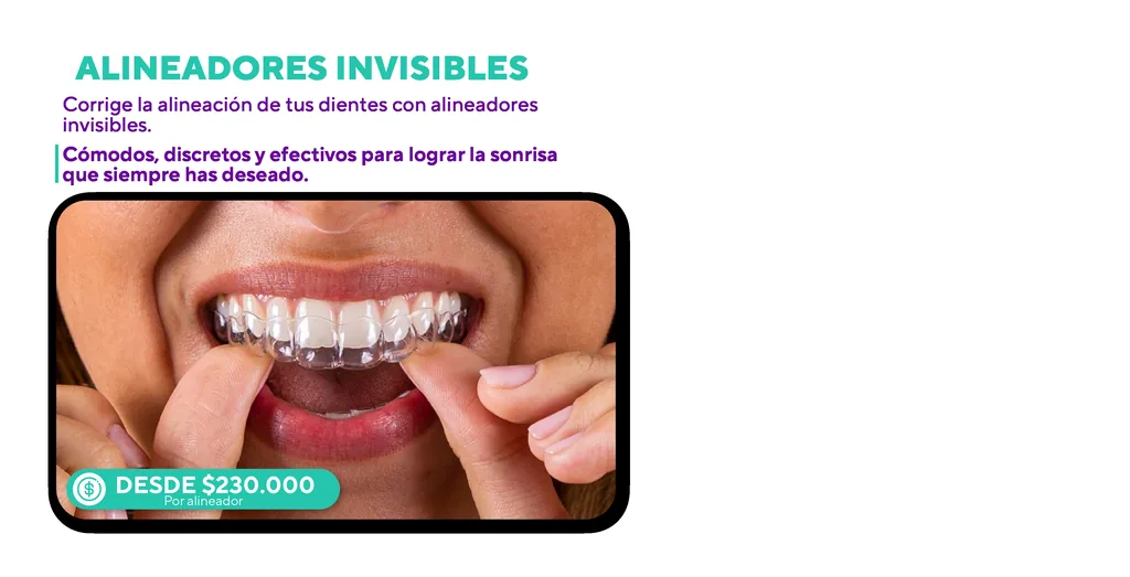 Promoción de alineadores invisibles desde $230.000 por alineador