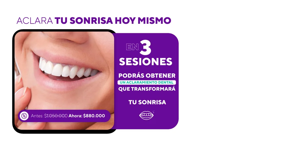 Promoción de aclaramiento dental en 3 sesiones